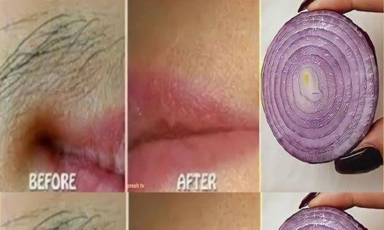 Onion is a natural and effective way to get rid of unwanted facial hair.