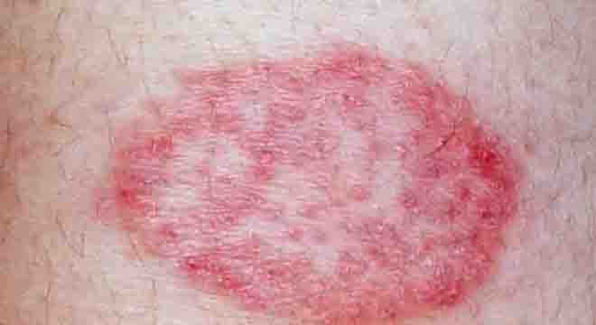 Serious Diseases Diagnosed Via Skin Signals