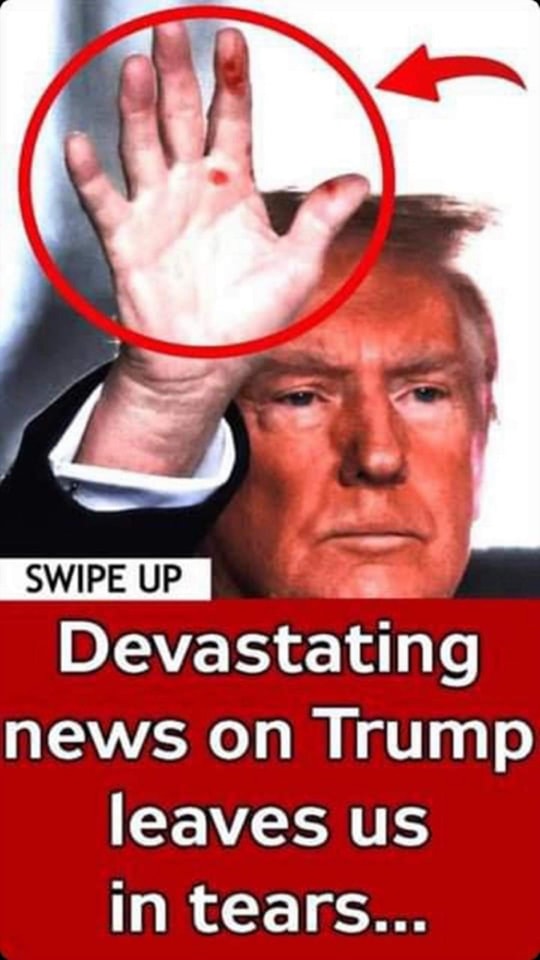 Dermatologist reveals what could be the mystery marks on Trump’s hand