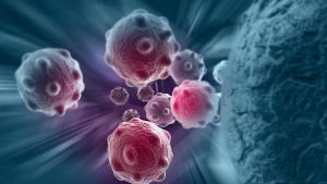 Most Dangerous Cancers in Men and Women s7