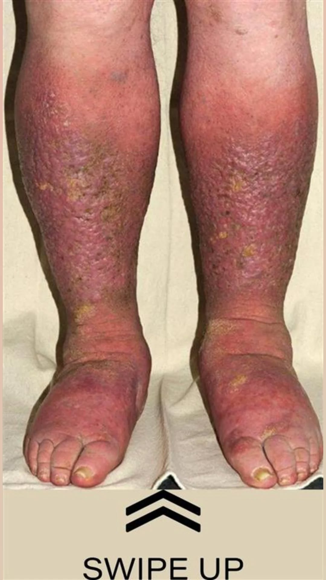 How Your Feet Could Be Signaling Heart Problems and Clogged Arteries