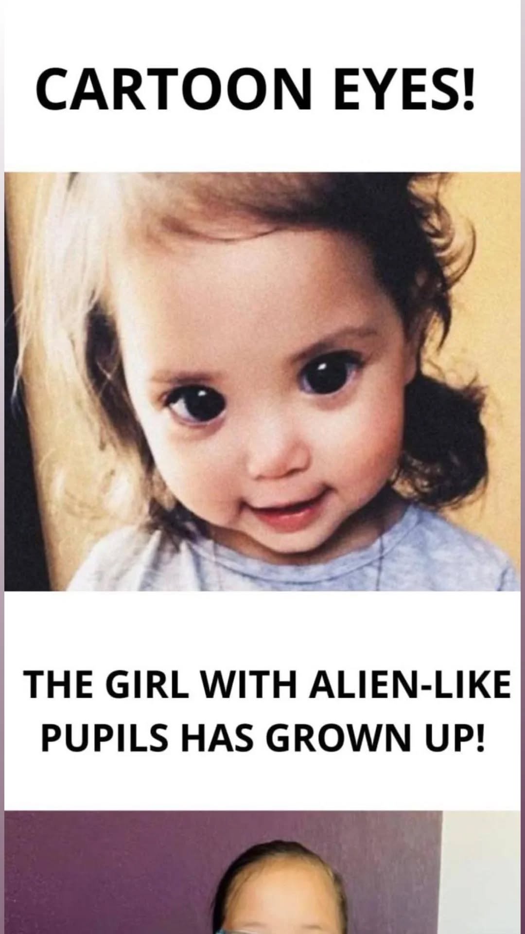 Melanie’s Journey: From ‘Alien’ Eyes to Embracing Uniqueness and Normalcy