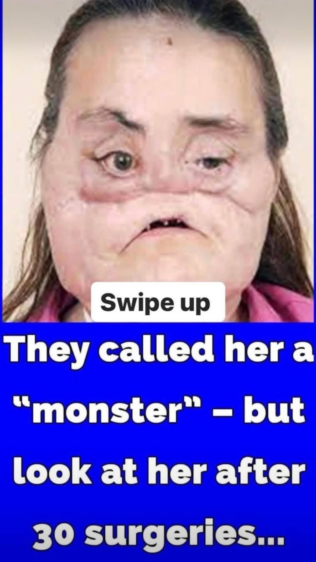 Connie Culp became the first-ever face transplant patient in the US: Inside her remarkable story