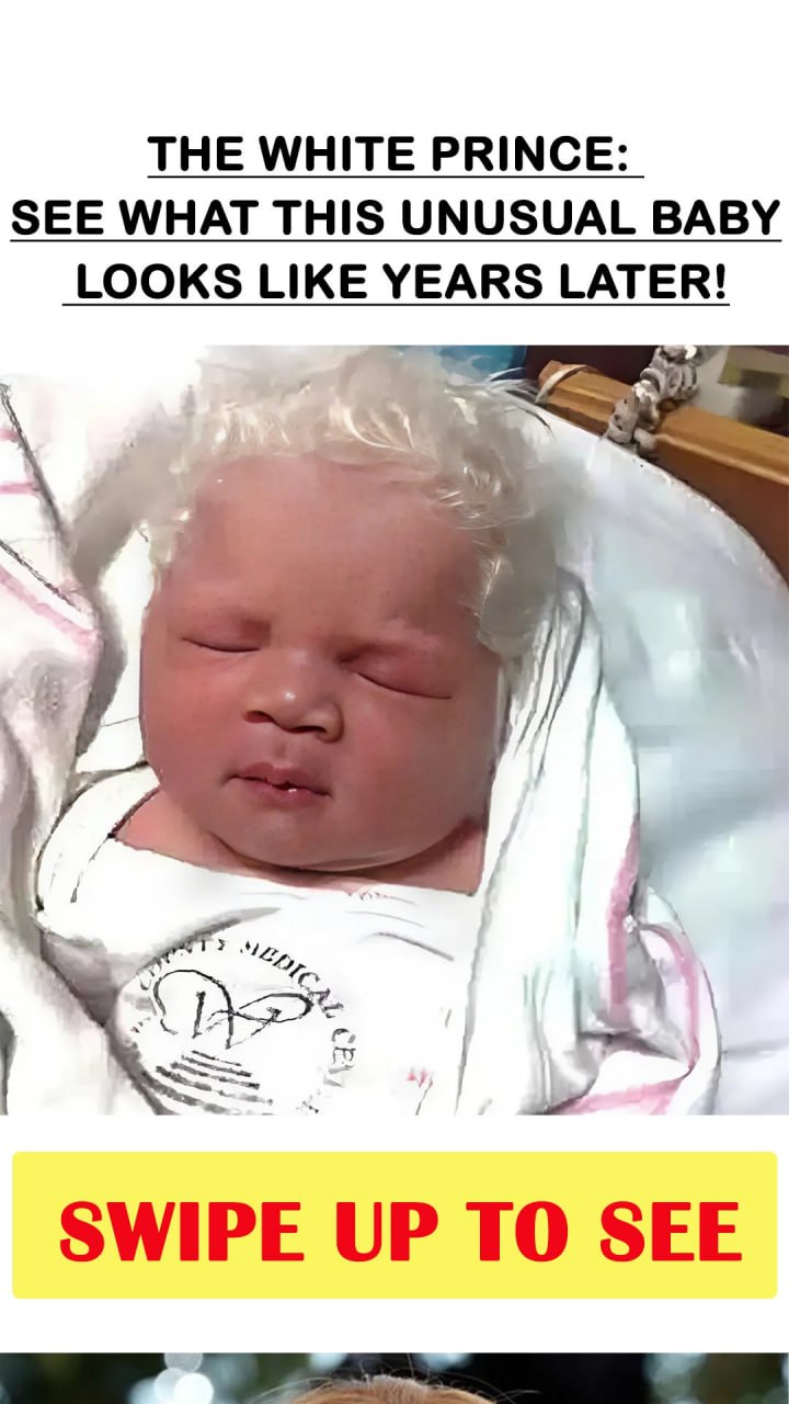 A Remarkable Mystery: Meet the Unique Baby Born With White Hair