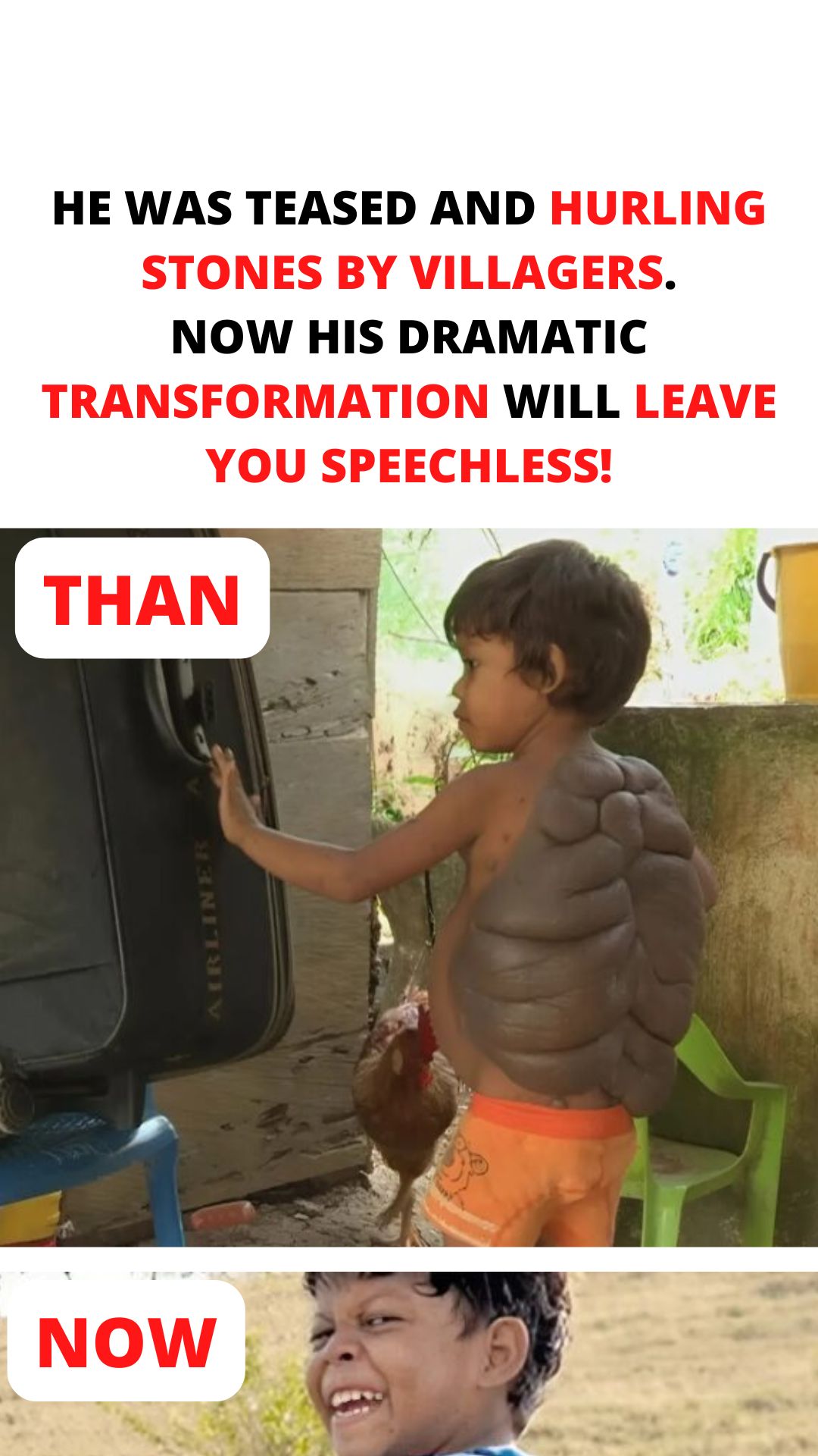 Once Bullied and Pelted with Stones by Villagers, His Incredible Transformation Will Astonish You!