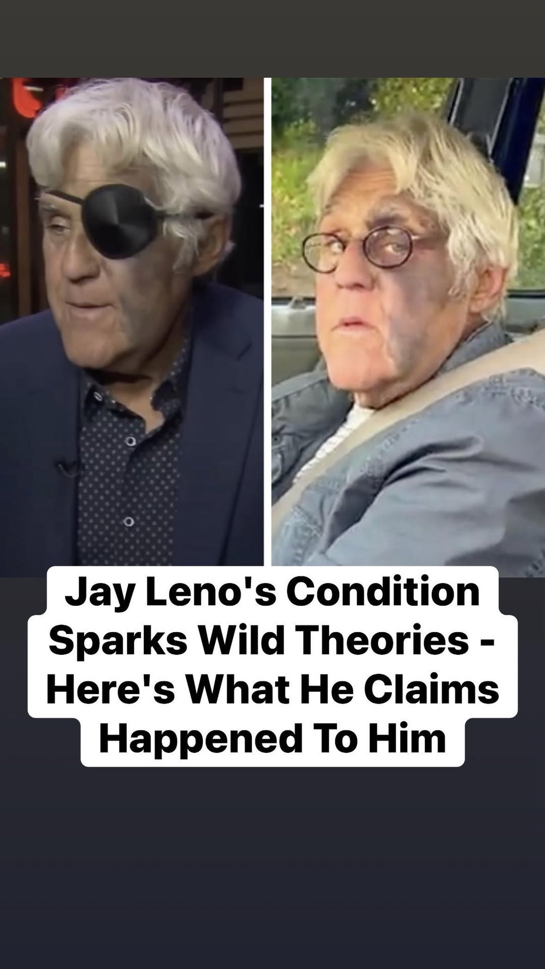 Jay Leno’s Condition Sparks Wild Theories – Here’s What He Claims Happened To Him