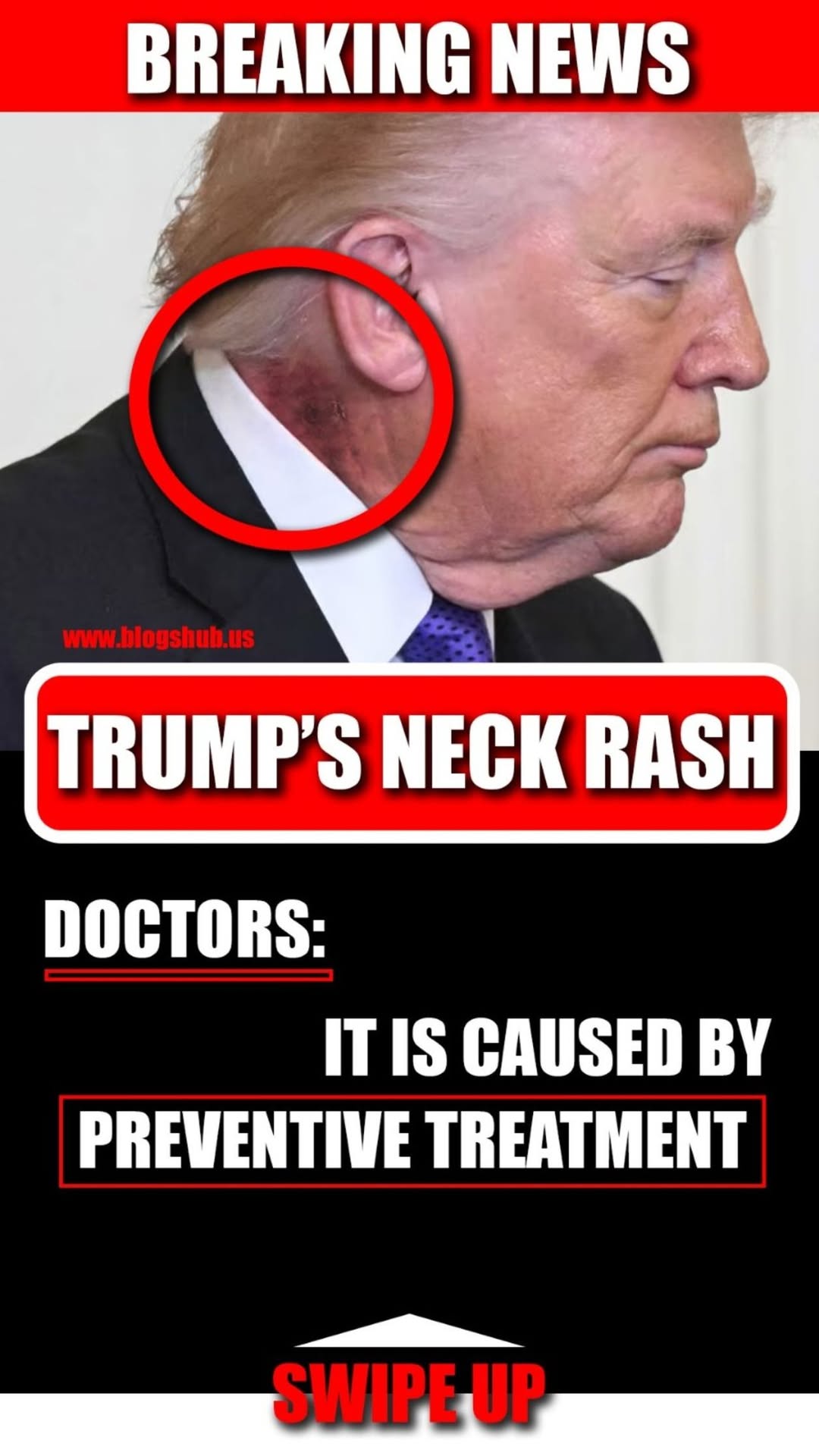 Trump’s neck rash is because of ‘preventative skin treatment,’ his doctor says